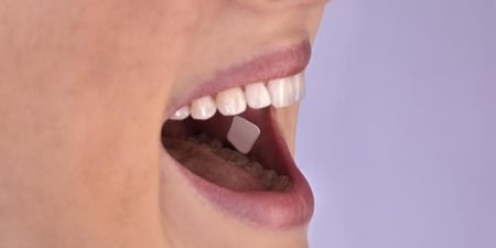 image of oral transmucosal drug delivery